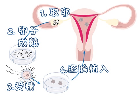 代生供卵公司